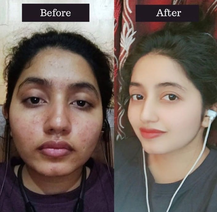 মেকমিব্রাইট অ্যাভোকাডো হোয়াইটেনিং ক্রিম