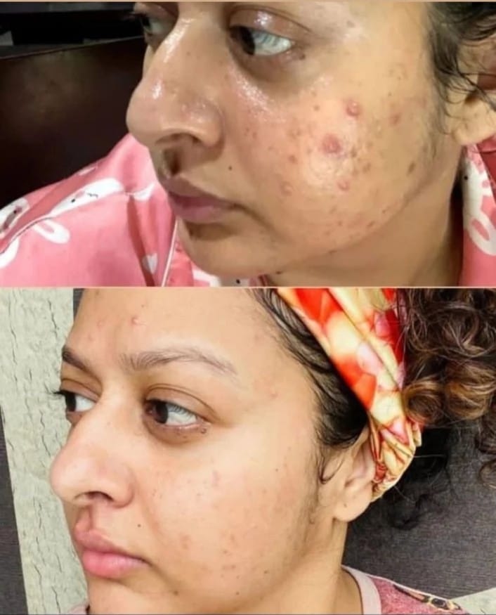 মেকমিব্রাইট অ্যাভোকাডো হোয়াইটেনিং ক্রিম