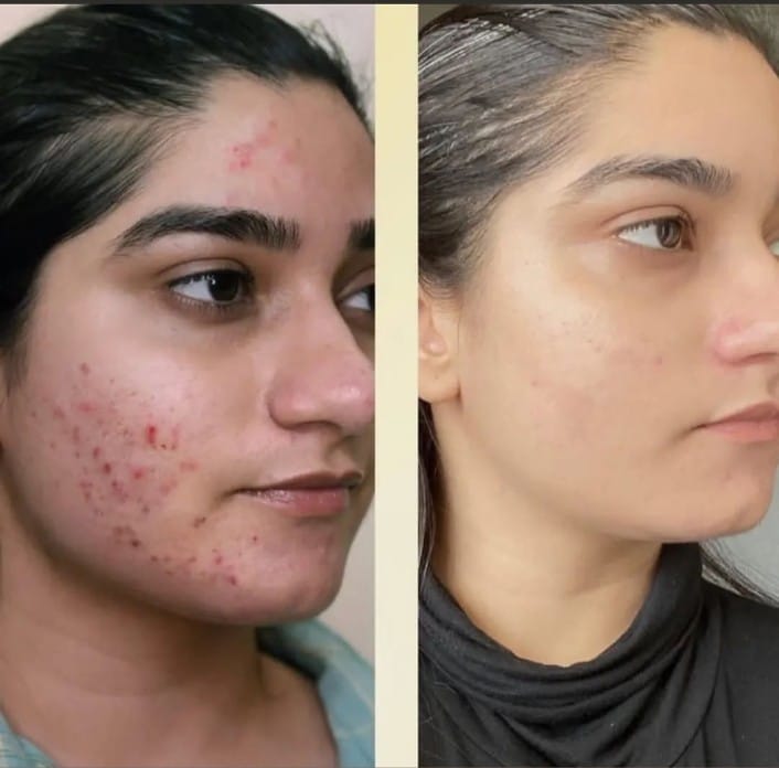 মেকমিব্রাইট অ্যাভোকাডো হোয়াইটেনিং ক্রিম